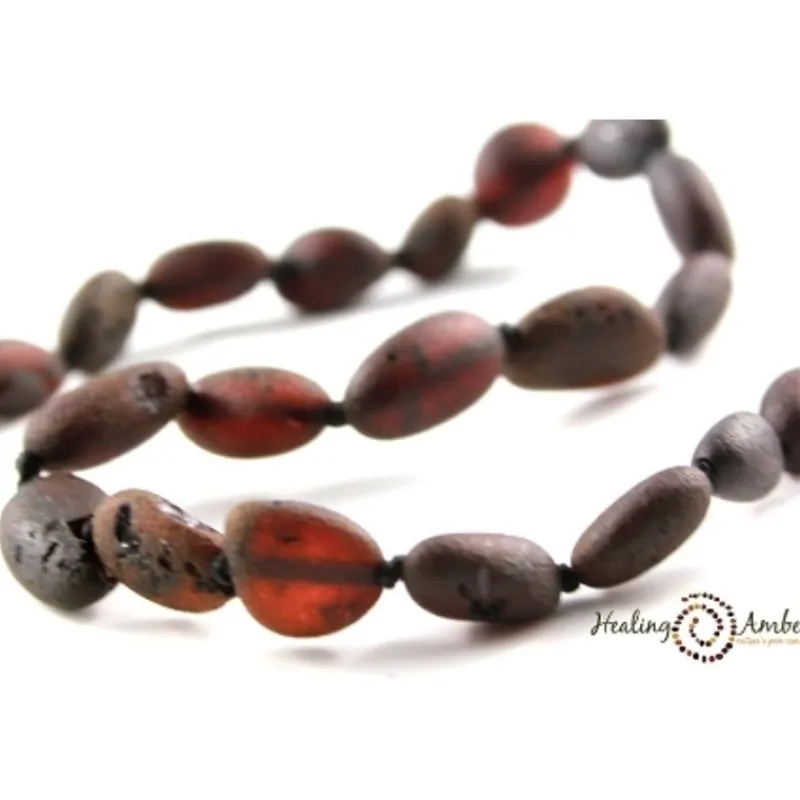 Healing Amber Baltic Amber Teething Necklace - 17.5 Inch