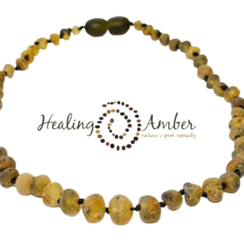 Healing Amber Raw Baltic Amber Teething Necklace - 11 inch