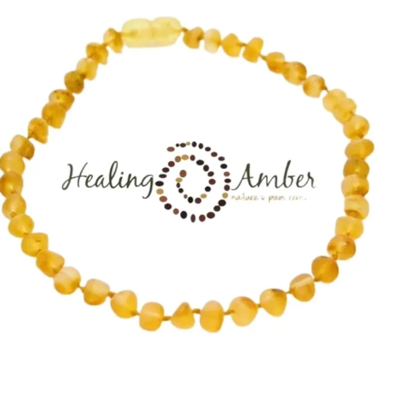 Healing Amber Raw Baltic Amber Teething Necklace - 13 Inch